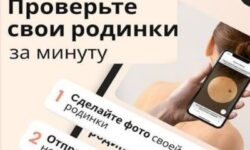 Приложение для ранней диагностики рака кожи «Про родинки» получило регудостоверение